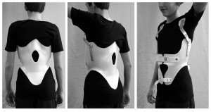 1280px-Kyphosis_brace1